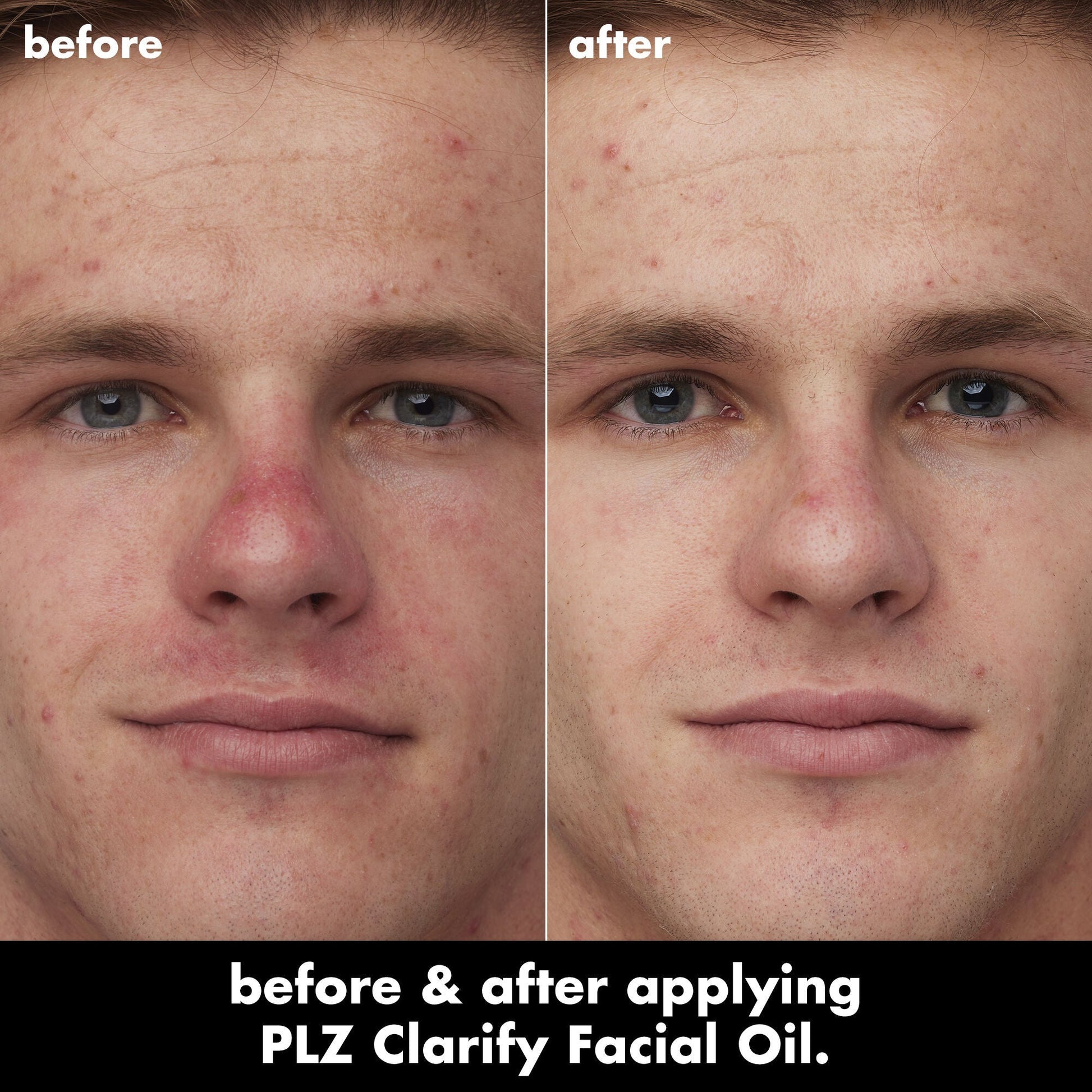 plz-clarify-facial-oil-x2 0326_EDU_PlzClarify_BA_Caleb.jpg