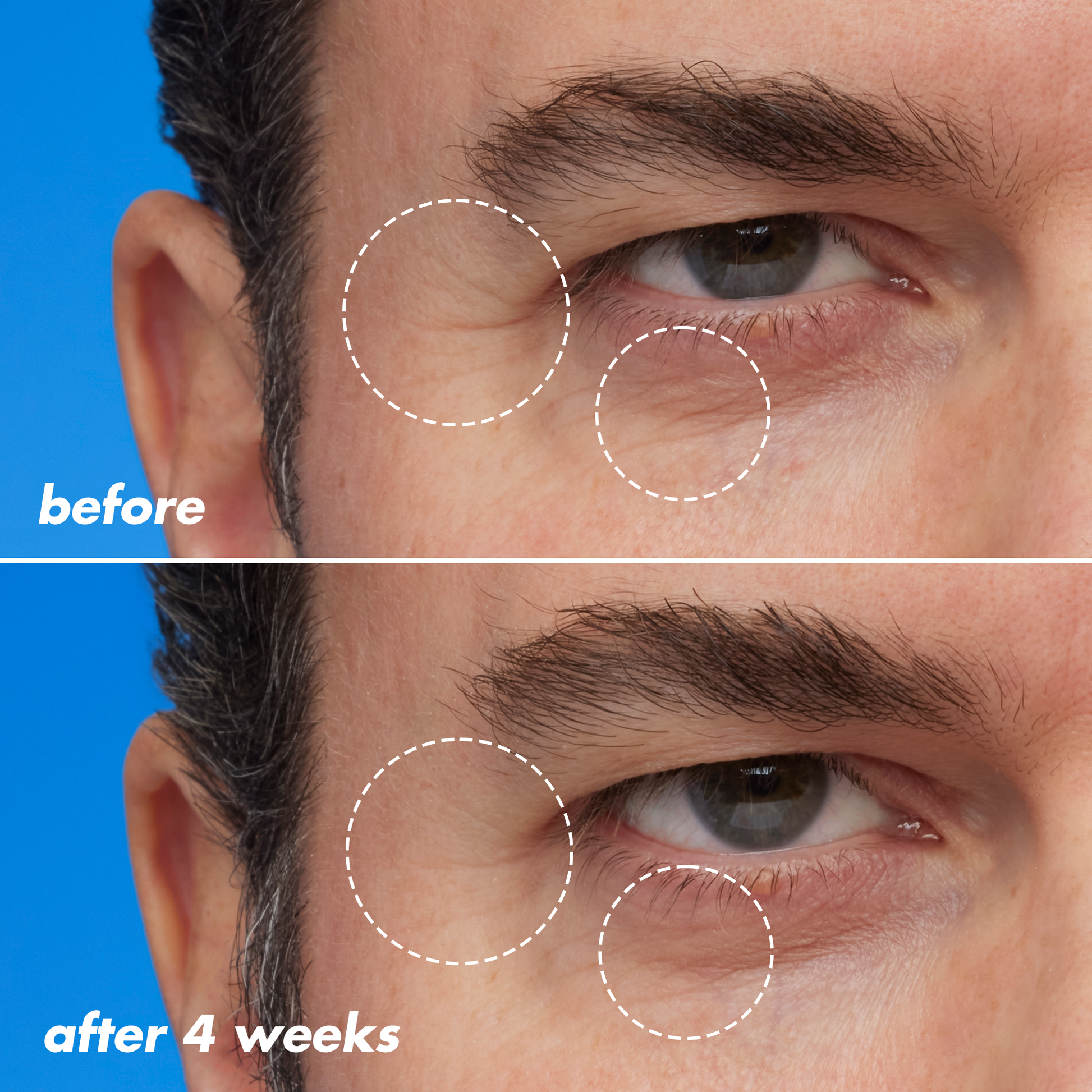 youth-boosting-blue-ty-sleep-night-oil-e0 EDU_Bluety_PDP_Paul.png