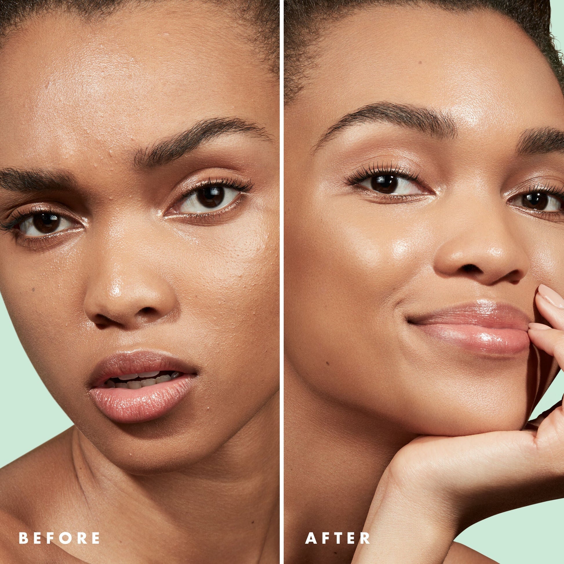 blemish-control-face-primer-large-size-b5 Primer_PP_Before_After_BlemishControl_2000x2000_3774231e-d4e1-49dd-b3d7-a73cbac901fe.jpg