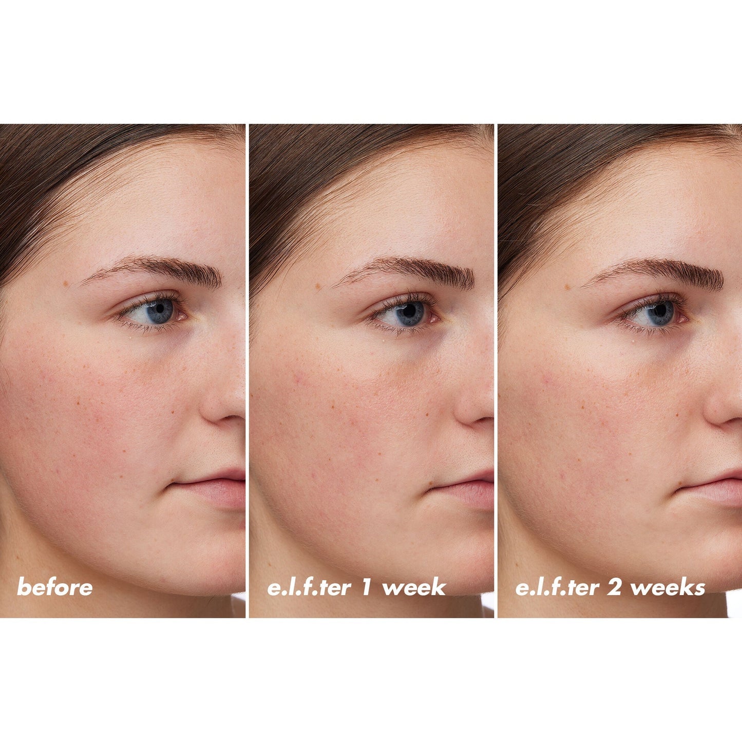 holy-hydration-barrier-goals-cream-regular-g7 XX26_EDUCATION_HH-BarrierGoals_B_A_Zoe_TRYPTICH_74c905bd-67bd-4b91-b633-2b01a8905cb8.jpg
